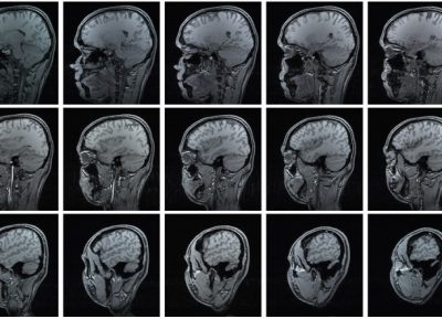 Nomofobia, vamping e like addiction. Le nuove patologie